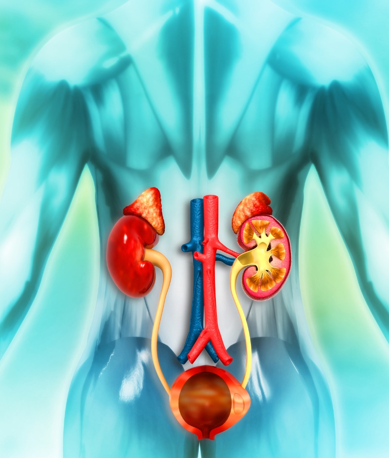Urethral Stricture