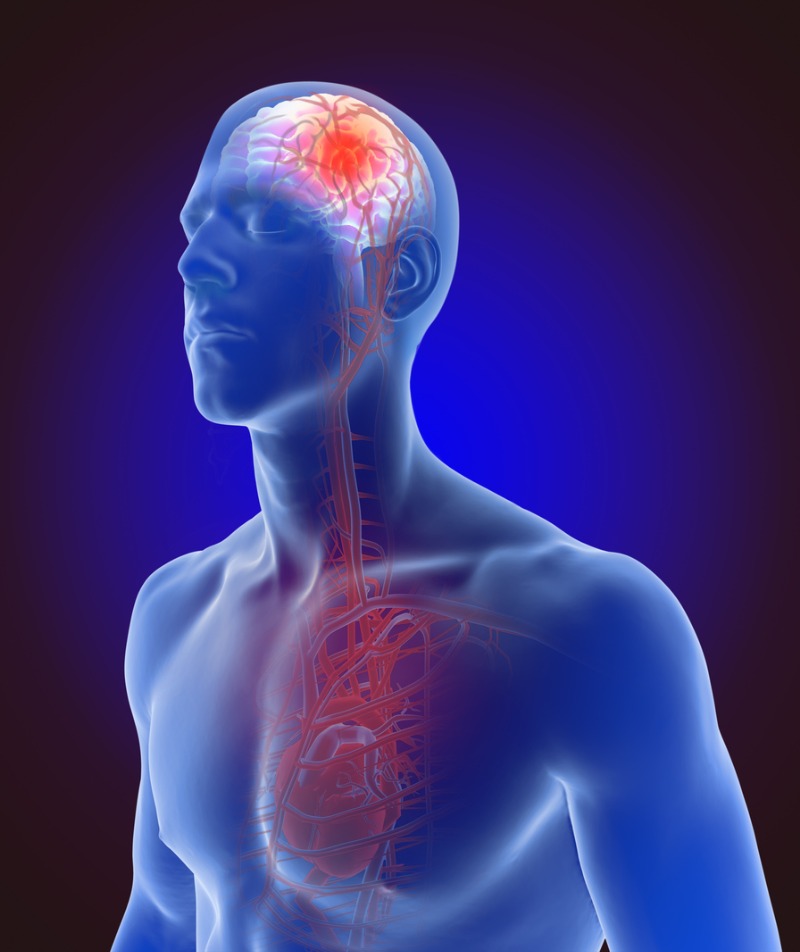 Cerebrovascular diseases