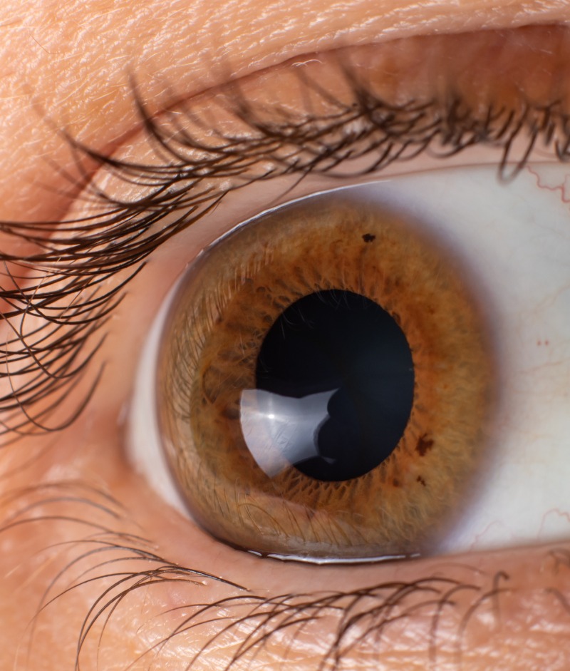 Cornea Transplant