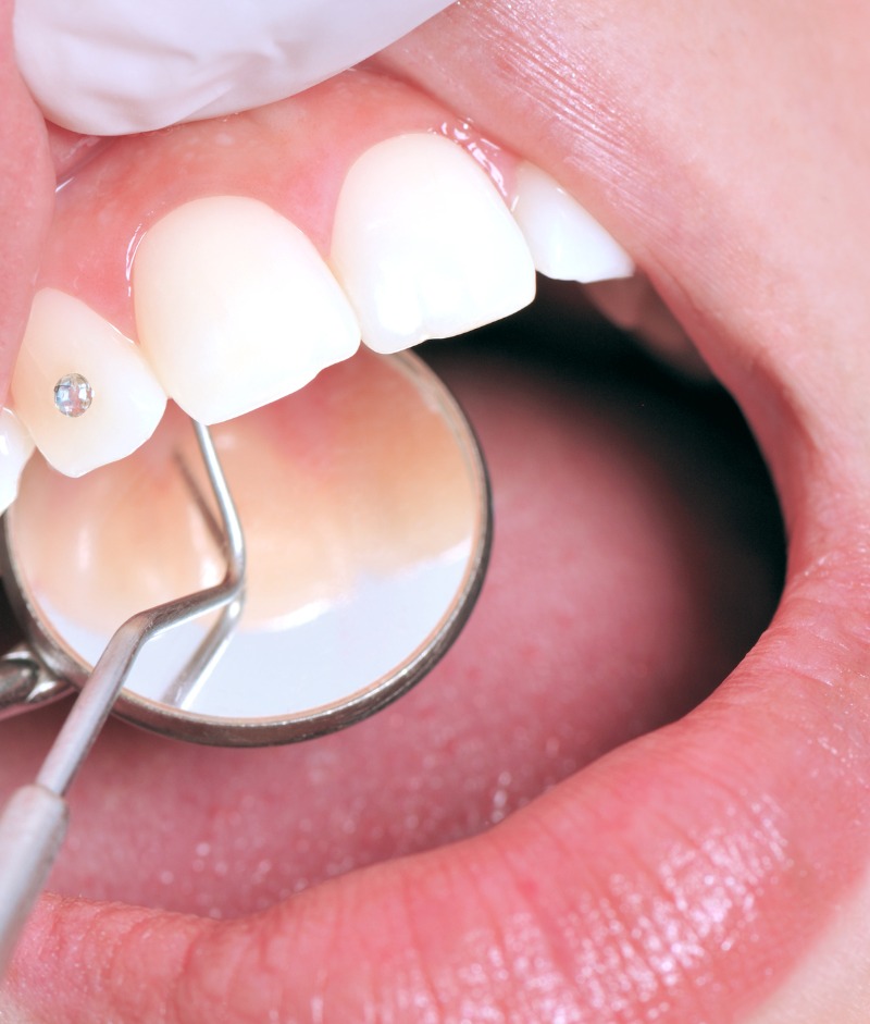 Teeth Jewellery Work