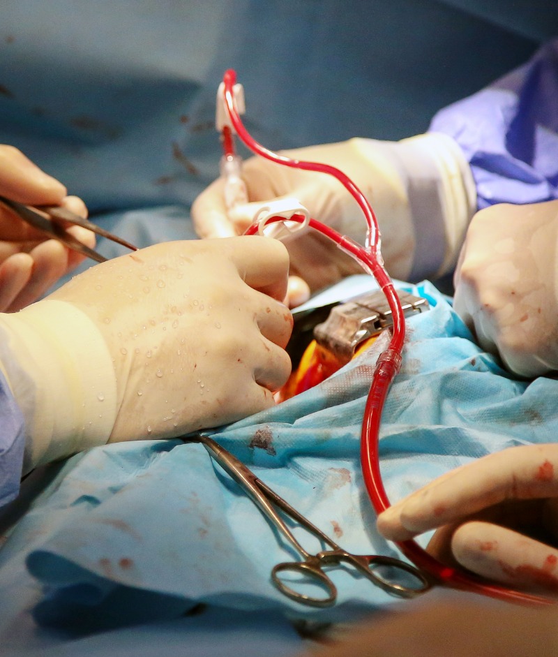 Heart valve surgery